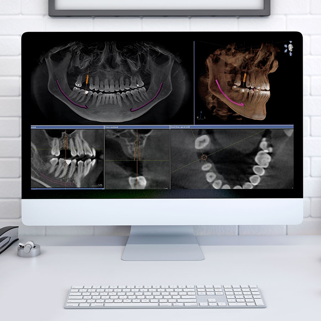 Radiografía Digital 3D